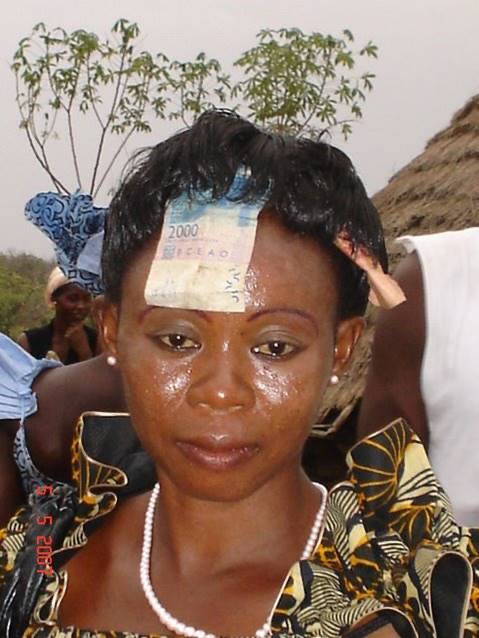 Figure 8: A girl after the procedure.